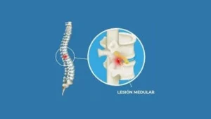 Lesionados medulares