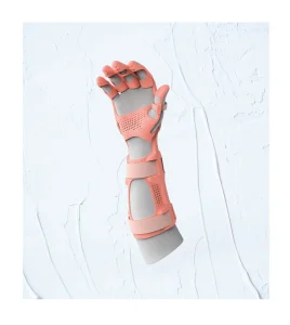 Ortesis 3D