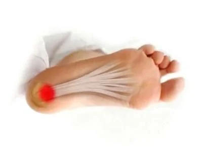 Plantillas para espolón calcáneo