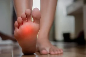 ¿Qué es el Neuroma de Morton?