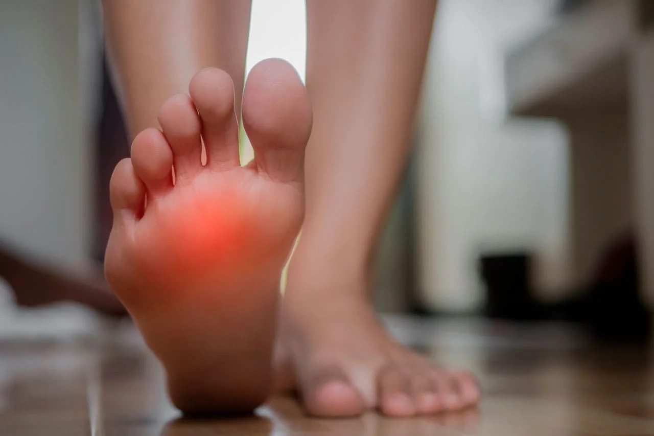 ¿Qué es el Neuroma de Morton?